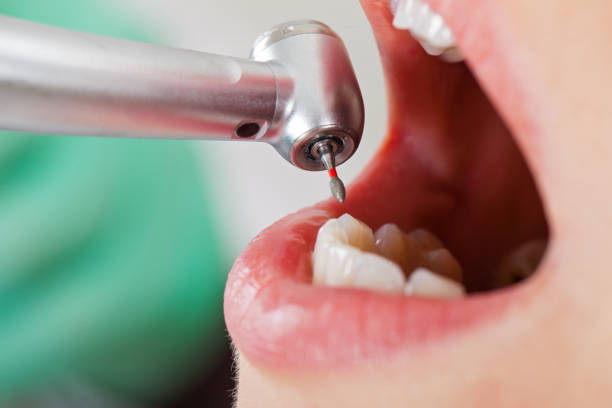 Best Emergency Dental Care for Sports Injuries in New Pek, IN